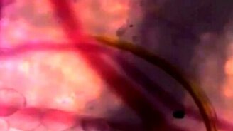 Укус комара под микроскопом - смотреть видео (0:58)