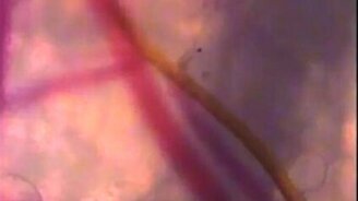 Как комар сосёт кровь - смотреть видео (0:43)