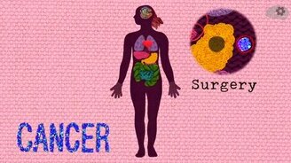 Чем раковые клетки отличаются от здоровых - смотреть видео (4:03)