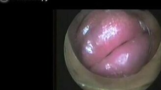 Губы тромбониста - вид изнутри - смотреть видео (1:56)