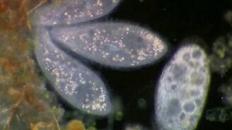 Микромир в тысячекратном увеличении - смотреть видео (6:45)