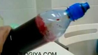 Кровь больного алкоголизмом - смотреть видео (0:30)