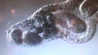 Амёба трапезничает - смотреть видео (0:41)