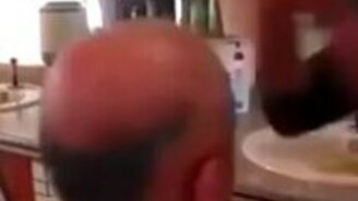 Растим волосы на лысине - смотреть видео (0:42)