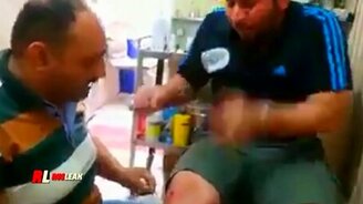 Невозмутимый хирург - смотреть видео (1:17)