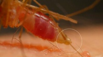 Как сосёт кровь комар - смотреть видео (3:17)