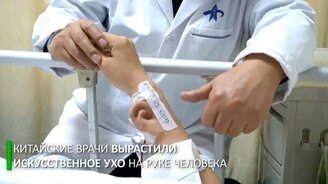 Вживление уха в руку - смотреть видео (1:06)