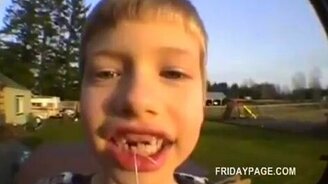 Вырываем зуб ракетой - смотреть видео (1:28)