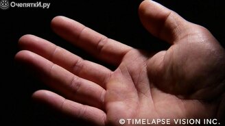 Как потеют подушечки пальцев - смотреть видео (1:03)