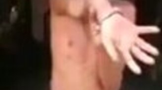 Когда ты ломал руку - смотреть видео (0:34)