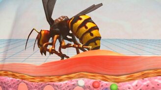 Самые ядовитые насекомые - смотреть видео (4:52)