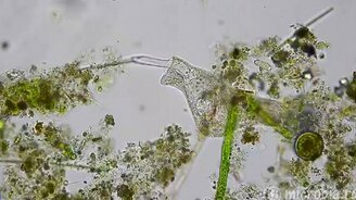 Потрясающая атака инфузории - смотреть видео (2:47)