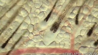 Корень волоса под микроскопом - смотреть видео (0:40)