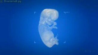 Как правильно умереть? - смотреть видео (0:41)