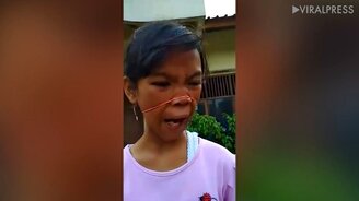 Трюк с резинкой на лице - смотреть видео (0:30)