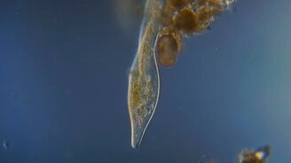 Инфузория-туфелька под микроскопом - смотреть видео (1:39)