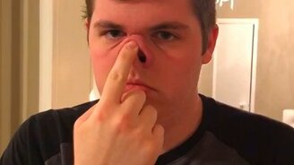 Нос-пятачок у парня - смотреть видео (0:14)