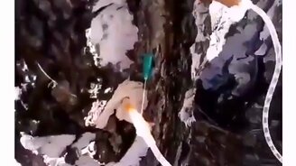 Медицинский подход к сбору берёзового сока - смотреть видео (0:17)